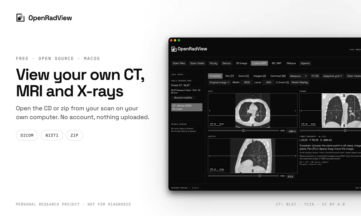 OpenRadView 截图 1